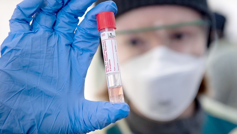 Eine Mitarbeiterin in einer Teststation hält ein Probenröhrchen mit einem Nasenabstrich in der Hand. Foto: DPA