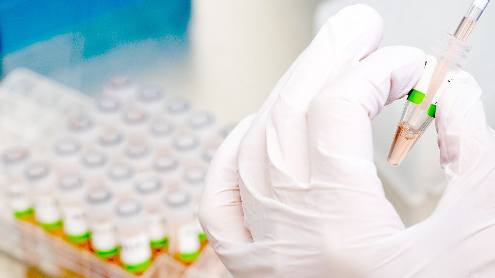 PCR-Tests in einem Labor des Niedersächsischen Landesgesundheitsamts (NLGA).Foto: DPA