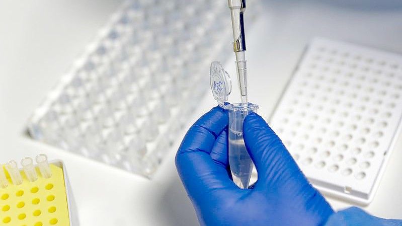 Eine Mitarbeiterin des Labors CBT füllt mit einer Pipette, zur Vorbereitung von PCR-Tests, eine Testflüssigkeit ein. Foto: Henning Kaiser/dpa