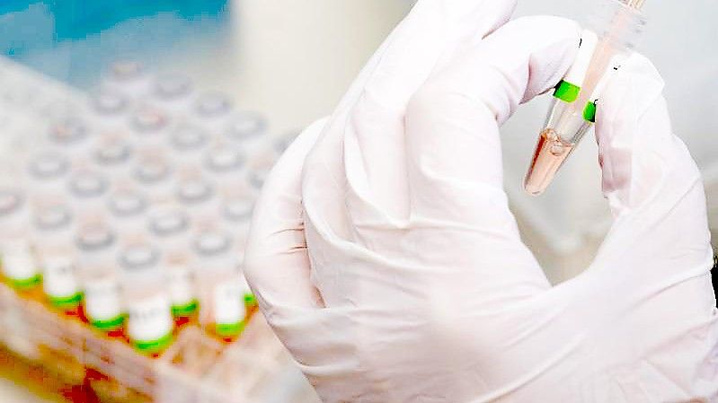 PCR-Tests werden im PCR-Labor vom Niedersächsischen Landesgesundheitsamt (NLGA) für die Analyse vorbereitet. Foto: Julian Stratenschulte/dpa