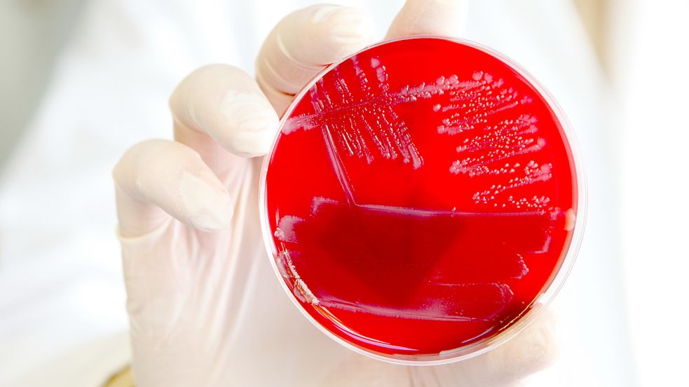 Wenn Bakterien rot sehen: Weil immer mehr von ihnen unempfindlich auf Antibiotika reagieren und diese wirkungslos werden, arbeiten Forscher an Alternativen. Foto: dpa / Bodo Marks