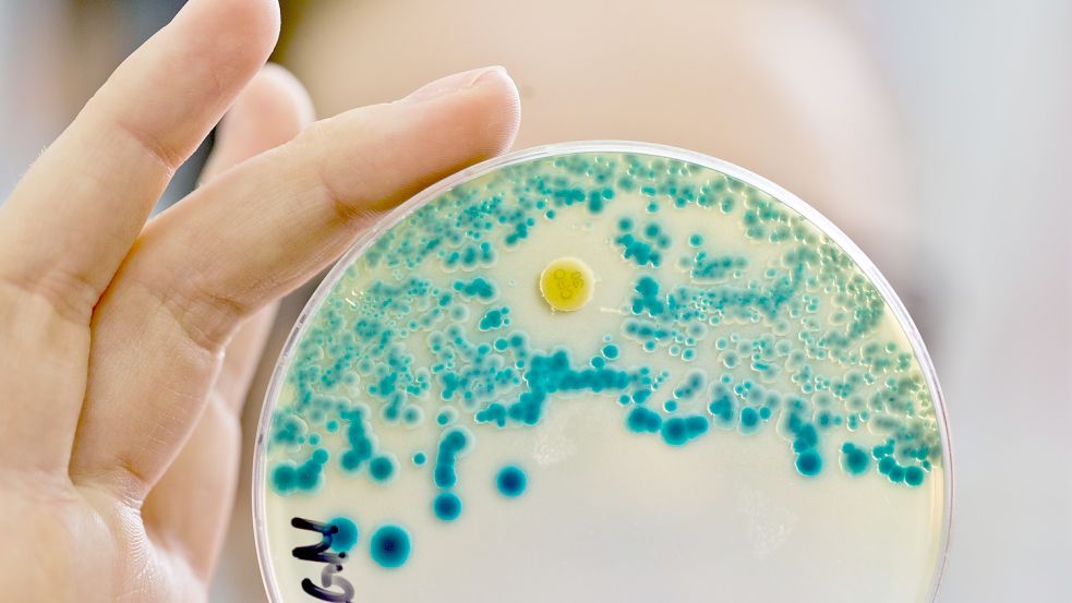 Weltweit nehmen bei Bakterien Unempfindlichkeiten gegen Antibiotika zu. Auf dem Bild zeigt eine Labormitarbeiterin eine Petrischale, in der Bakterien auf Resistenzen getestet werden. Foto: dpa / Daniel Karmann