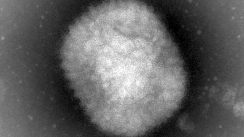 Das Affenpockenvirus unter dem Elektronenmikroskop. Erstmals sind im Mai auch in Deutschland Fälle von Affenpocken nachgewiesen worden. Foto: DPA