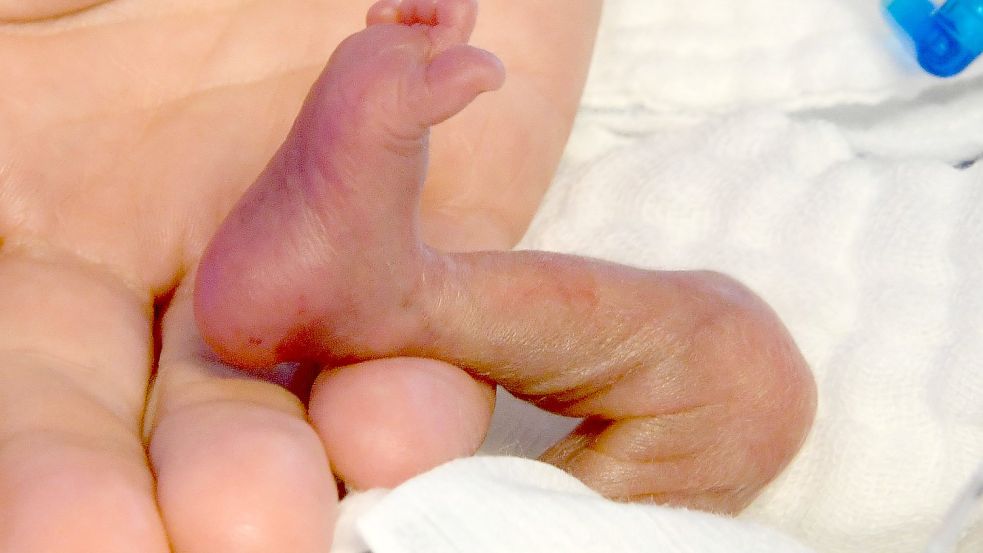 Der direkte Hautkontakt von Frühchen und Mutter bzw. Betreuungsperson noch vor dem Brutkasten, kann einen positiven Einfluss auf die Entwicklung der Kinder haben. Foto: picture alliance / Holger Hollemann/dpa