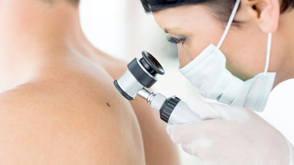 Beim Hautkrebs-Screening haben Dermatologen und Hausärzte die Möglichkeit, Hautkrebs bereits in einem frühen Stadium zu erkennen. Foto: AOK/hfr