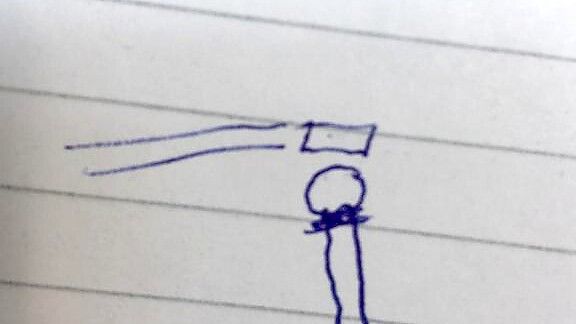 „Dr. Love“ hat unserer Autorin den Bruch erklärt und dafür ihren Arm auf ein Stick Papier gekritzelt. Weil das Krankenhaus in Hamburg zuerst den Stick nicht annehmen wollte, konnte sie zuerst nur dieses Bild vorzeigen. Foto: Laura Wolfert