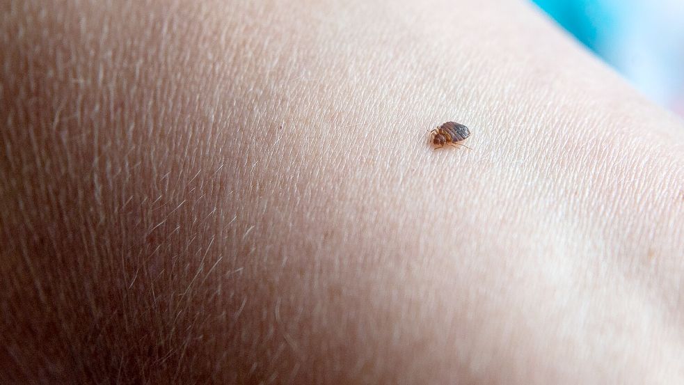 Bettwanzen saugen Blut und sondern dabei ein gerinnungshemmendes Sekret ab, das starken Juckreiz auslöst. Foto: dpa/Sina Schuldt