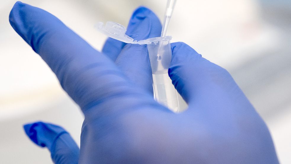Erstmals ist ein Mensch am Alaskapocken-Virus gestorben. Foto: dpa/Sven Hoppe
