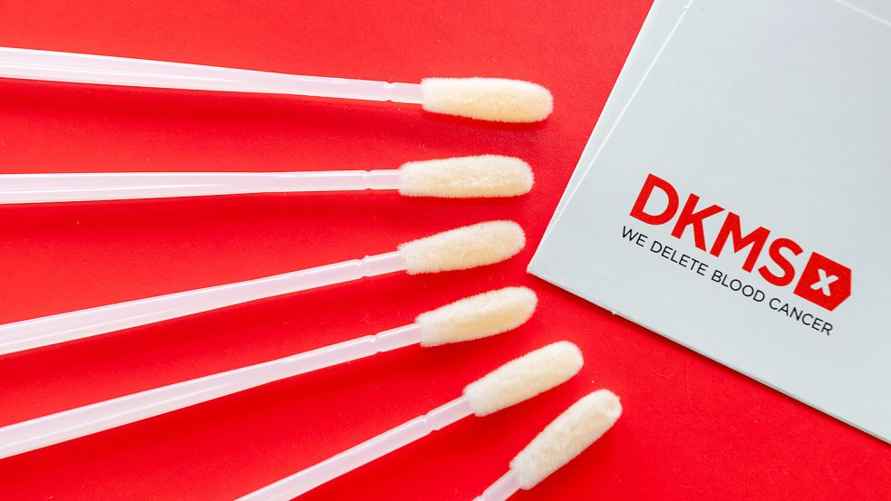 Medizinische Wattestäbchen zur Abnahme von Zellen aus der Wangenschleimhaut liegen auf einem Prospekt der Deutschen Knochenmarkspenderdatei (DKMS), in der Zellspender erfasst werden. Foto: DPA