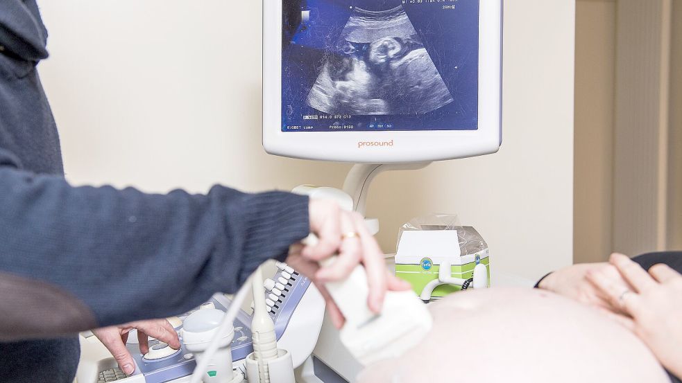 Ein Arzt untersucht eine schwangere Frau mit einem Ultraschallgerät während das Kind im Mutterbauch auf einem Display zu sehen ist. Foto: Jasper Jacobs/DPA