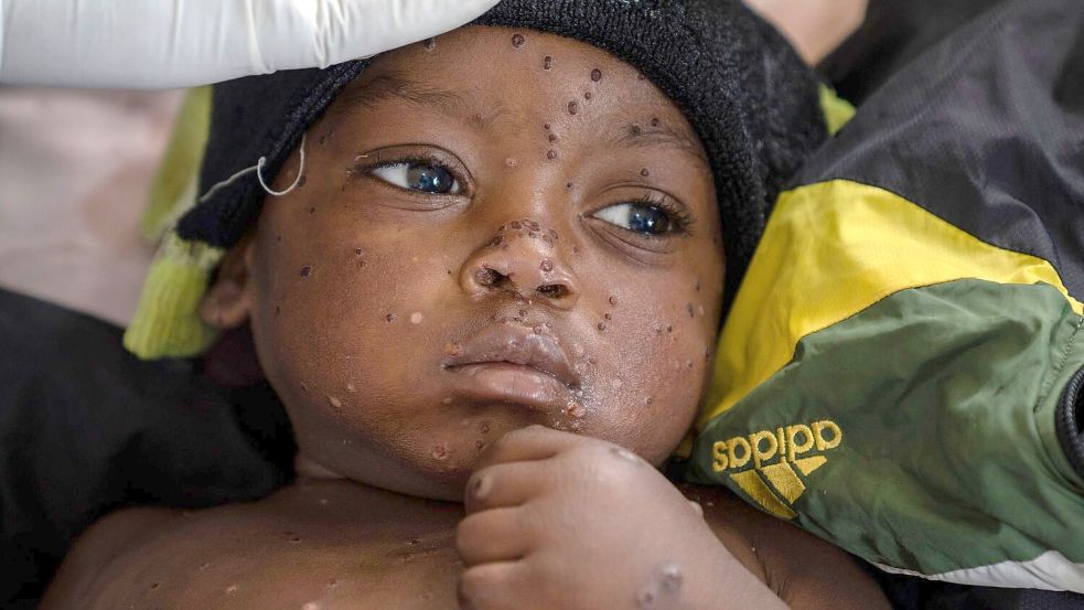 Ein besorgniserregendes Risiko sehen die beiden Experten für Übertragungen zwischen Kindern. (Archivbild) Foto: Moses Sawasawa/AP/dpa