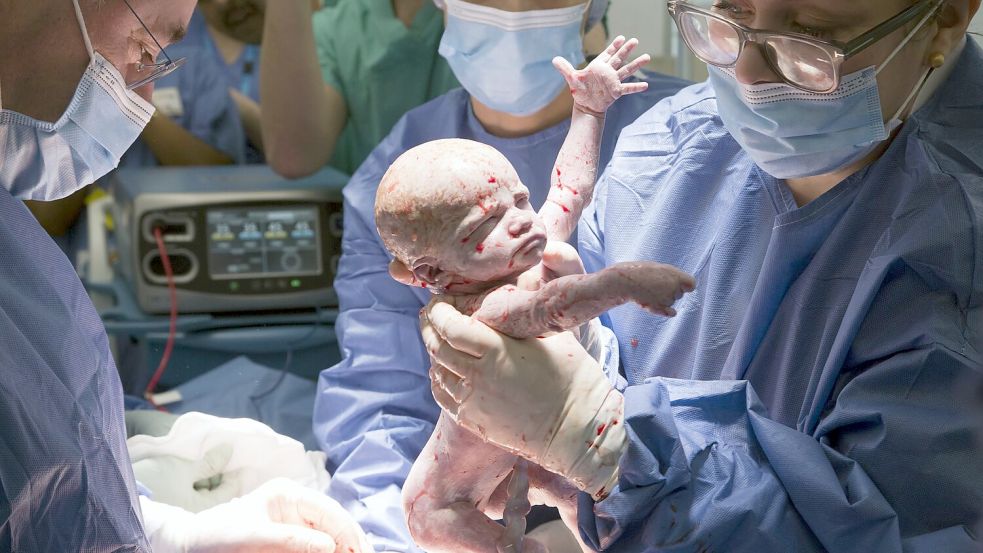 Es soll der erste solche Fall in Großbritannien gewesen sein. Foto: Womb Transplant Uk/PA Media/dpa