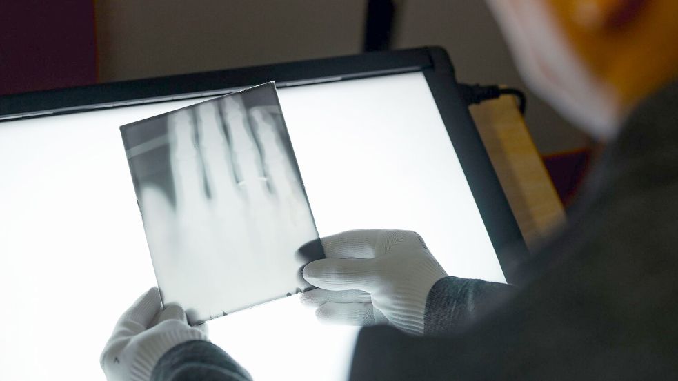 Ein Röntgenbild der Hand von Wilhelm Röntgen gehört nun zum Unesco-Weltdokumentenerbe. (Archivbild) Foto: Marius Becker/dpa