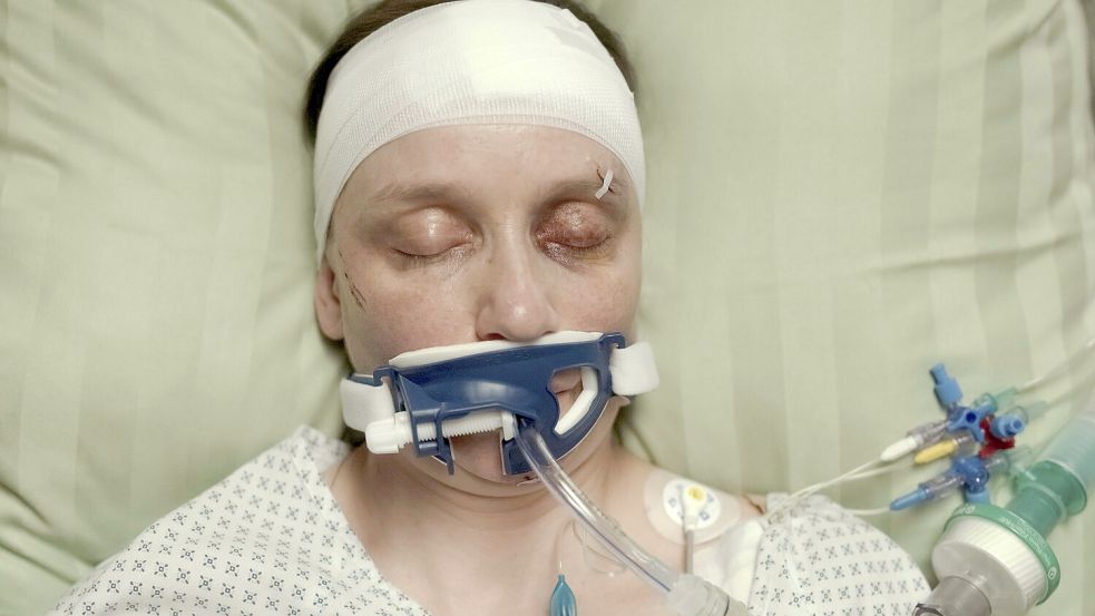 Unfallopfer Sarah (Mareike Sedl) kämpft im Krankenhaus um ihr trauriges Leben. „Polizeiruf 110: Widerfahrnis“ am Sonntag, 4. Mai um 20.15 Uhr im Ersten und in der ARD Mediathek. Foto: MDR/filmpool fiction/Stefan Erhard