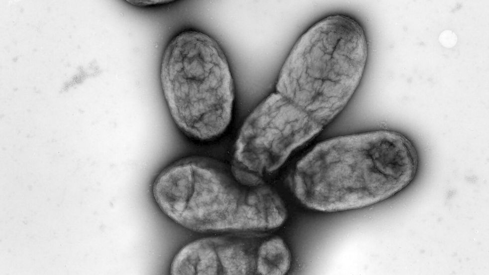 Das Pestbakterium Yersinia pestis Foto: picture alliance / dpa