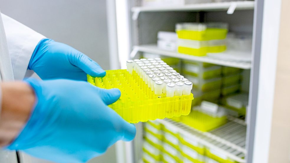 Ehec steht für enterohämorrhagische Escherichia coli und bezeichnet bestimmte krankmachende Stämme dieses im Darm vorkommenden Bakteriums. Foto: Guido Kirchner/dpa