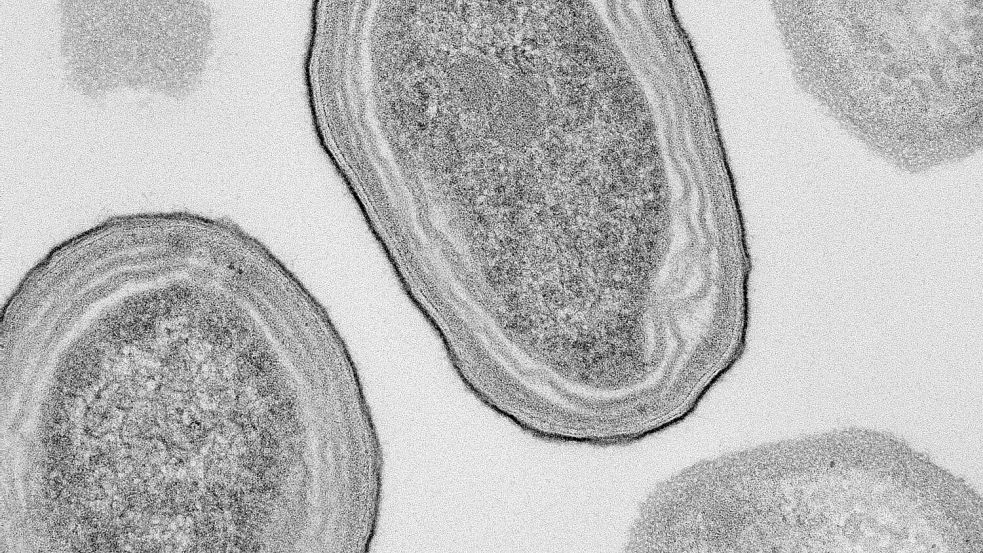 Elektronenmikroskopische Aufnahme von Prochlorococcus-Zellen. Foto: Natalie Kellogg