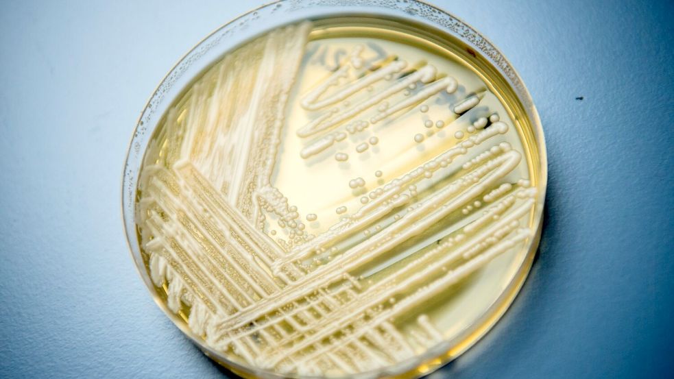 Der Hefepilz Candidozyma auris (früher bekannt als Candida auris). Foto: Nicolas Armer/dpa