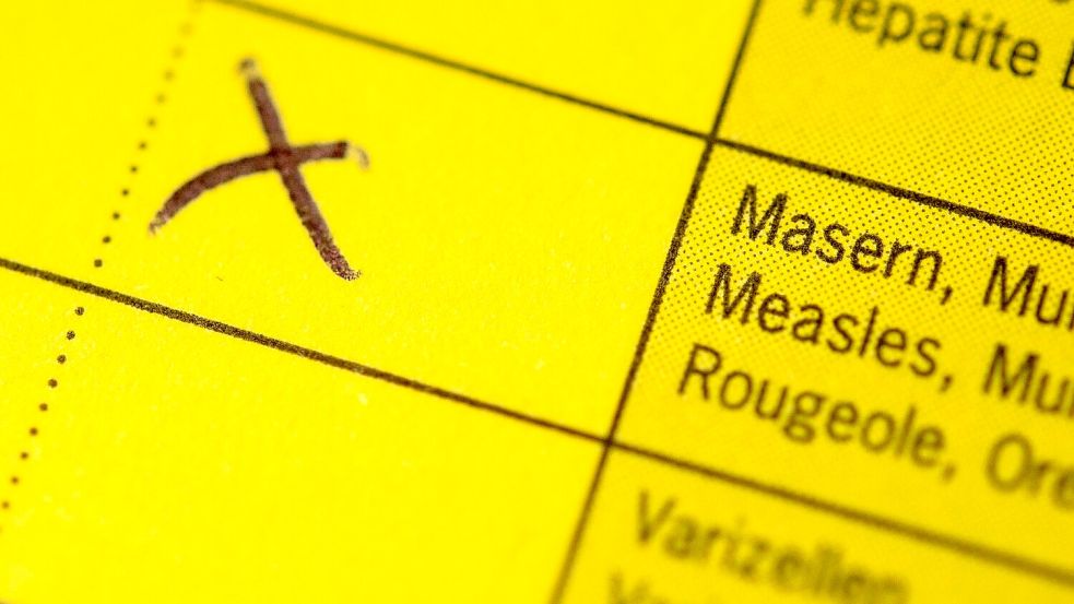 Kanada kämpft gegen einen Masern-Ausbruch. (Archivbild) Foto: Marius Becker/dpa
