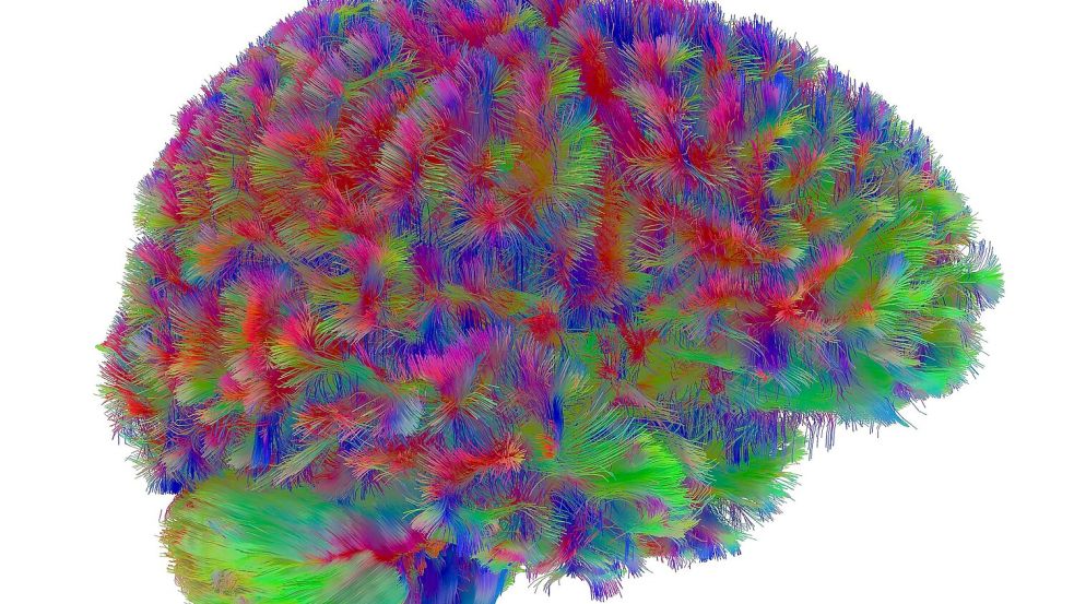 Sogenannte MRT-Diffusionsscans lassen deutliche Unterschiede der Hirnstruktur abhängig vom Alter erkennen. Foto: Dr Alexa Mousley/University of C