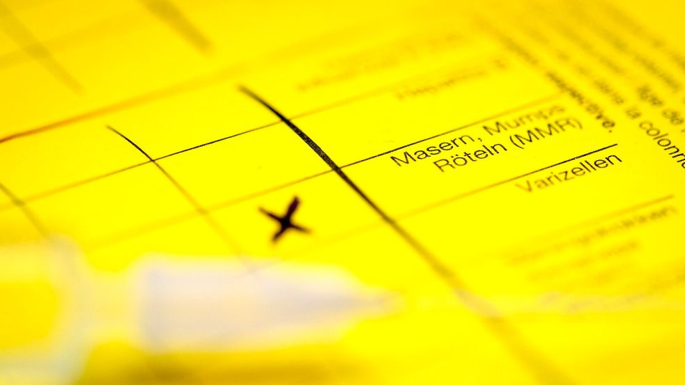 Bei Masern zeigt sich erst oft Fieber, bevor später ein Hautausschlag dazukommt. (Symbolbild) Foto: Friso Gentsch