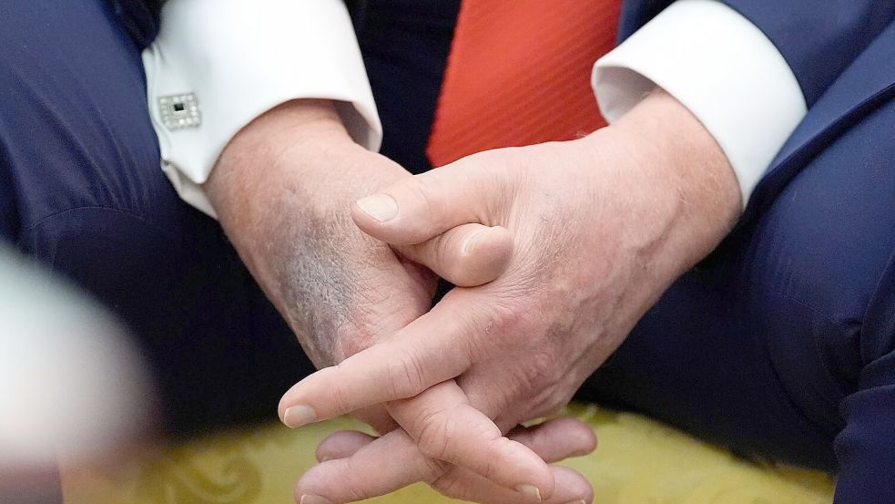 Blaue Flecken geben immer wieder Anlass für Spekulationen. (Archivbild) Foto: Alex Brandon/AP/dpa