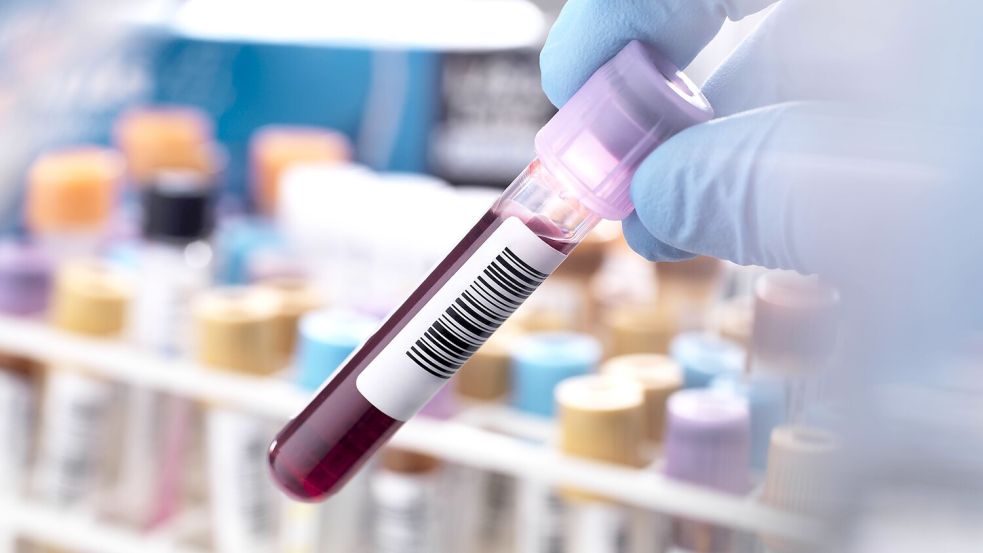 Eine Blutprobe im Entnahmeröhrchen: Jetzt berichtet eine ehemalige Mitarbeiterin, wie der Geschäftsführer den Betrug aufgezogen hat. Foto: IMAGO/Andrew Brookes