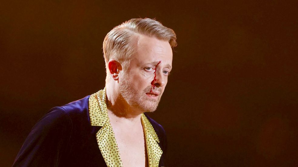 Ross Antony war sichtlich gezeichnet, nahm die Sache aber mit Humor. Foto: Rolf Vennenbernd