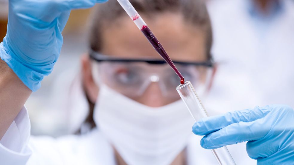 Angst vor dem Hanta-Virus: Laboratin bei der Analyse. Foto: IMAGO / Zoonar