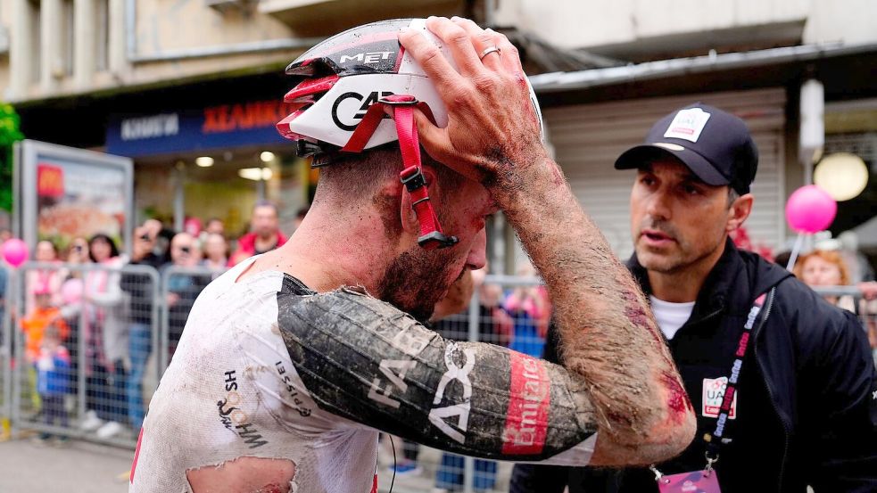 Mitfavorit Adam Yates stürzte beim Giro d’Italia schwer. Foto: Fabio Ferrari/LaPresse/AP/dpa