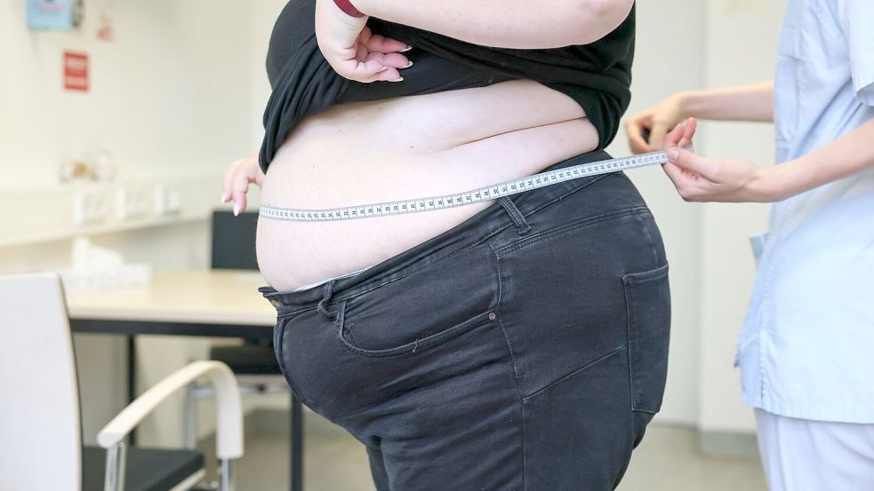 Laut Daten des Statistischen Bundesamtes von 2025 sind in Deutschland 17,9 Prozent der Erwachsenen adipös. (Symbolbild) Foto: Jan Woitas