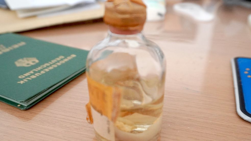 Ganz klein ist das Gefäß, in dem Axel Pante seinen Blinddarm aufbewahrt. Foto: Alicia Heskamp