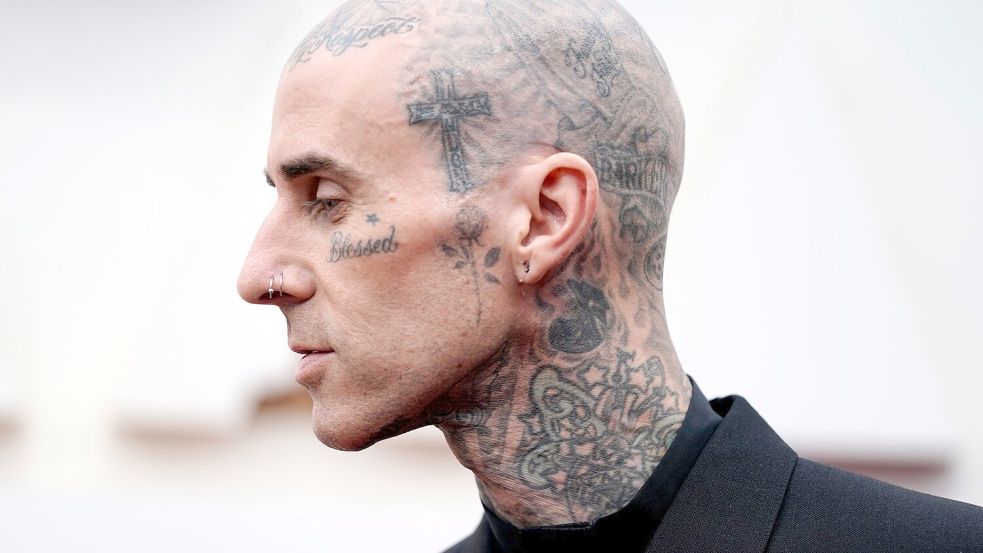 Travis Barker geht davon aus, dass er in ein paar Wochen wieder fit ist. (Archivbild) Foto: Jae C. Hong/Invision/AP/dpa